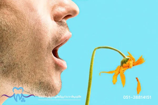 بوی بد دهان بعد از کامپوزیت + آیا کامپوزیت باعث بوی بد دهان میشود؟