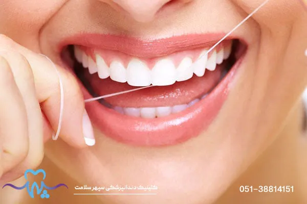 بلیچینگ دندان یا روکش دندان؟ کدام گزینه برای شما بهتر است؟
