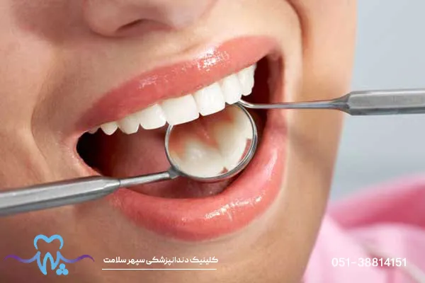 بستنی خوردن بعد از ایمپلنت دندان