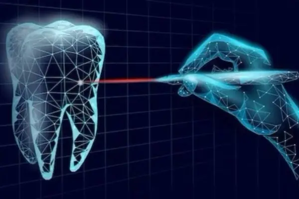 AI-Dental