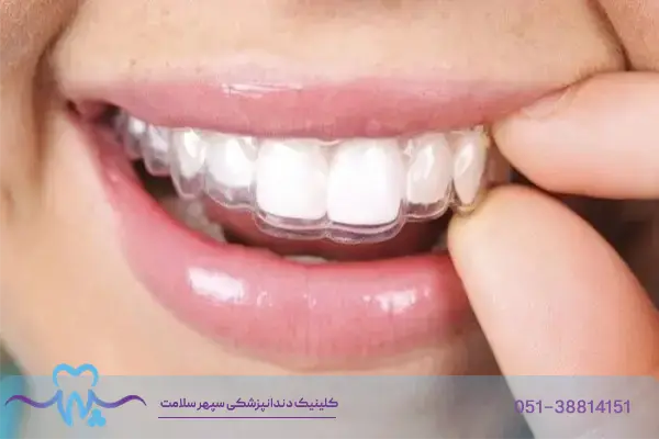 نایت گارد