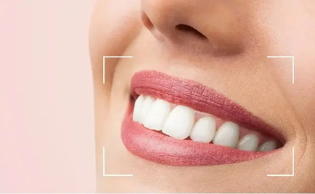 طراحی لبخند