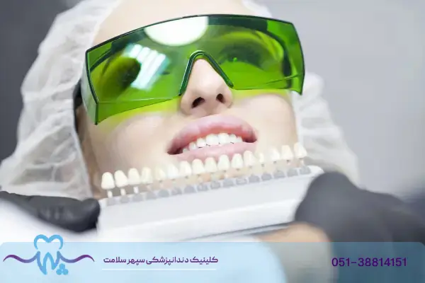 مراقبت لمینت
