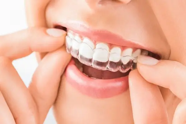 چه مدت باید از نایت گارد استفاده کرد