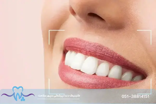 طراحی لبخند