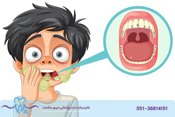 انواع بیماری دهان و دندان
