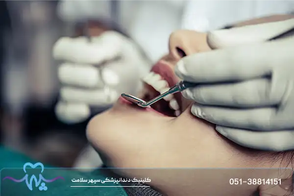مزایای جرمگیری ایمپلنت دندان و نکات کلیدی برای مراقبت از آن