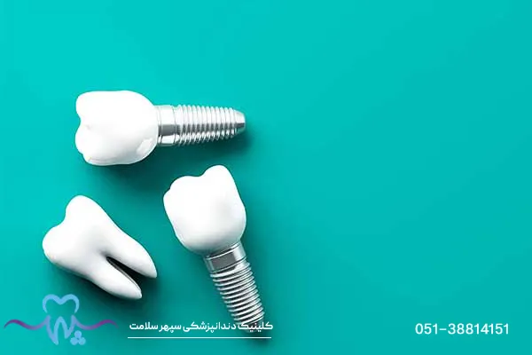 فرق ایمپلنت با کاشت دندان؛ کدام روش برای شما بهتر است؟