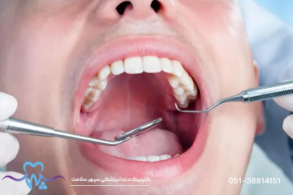 نحوه درست خوابیدن بعد از جراحی ایمپلنت