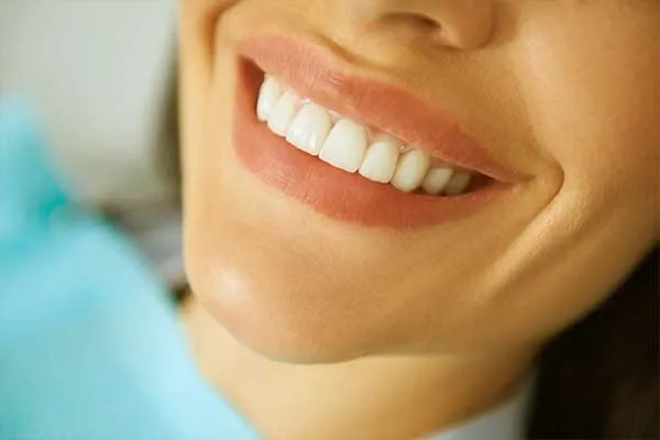 چرا کامپوزیت با روکش «هماهنگ» نیست؟