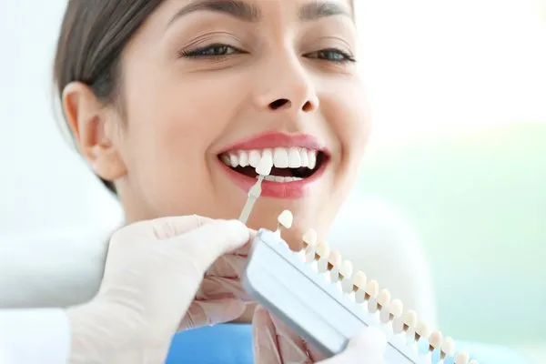 بعد از کامپوزیت دندان چه نخوریم؟