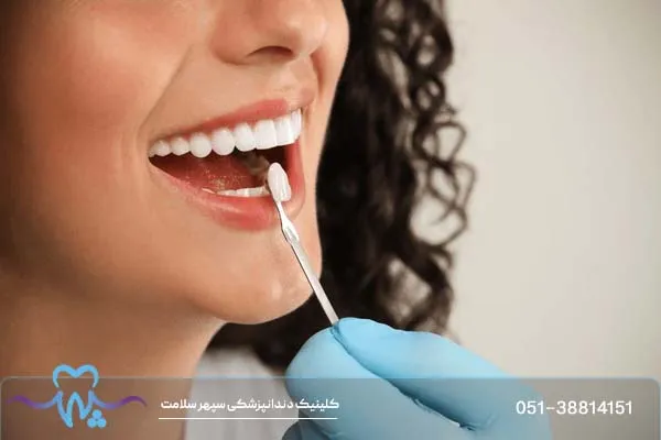 تغذیه بعد از کامپوزیت دندان: چه بخوریم و چه نخوریم؟