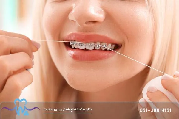 چرا ارتودنسی؟ عواقب انجام ندادن این درمان چیست؟