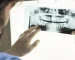 درمان ایمپلنت به CBCT
