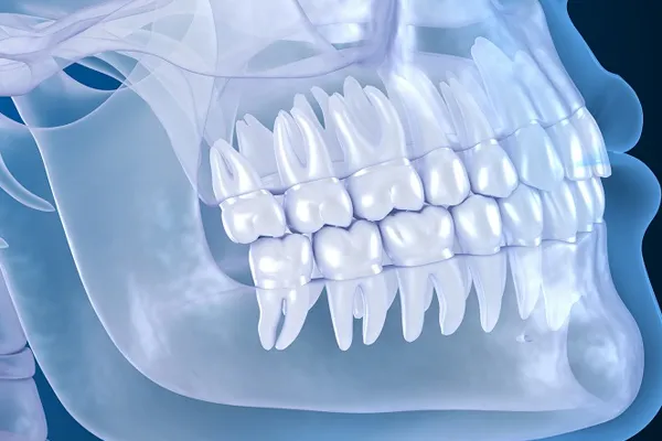 CBCT چیست