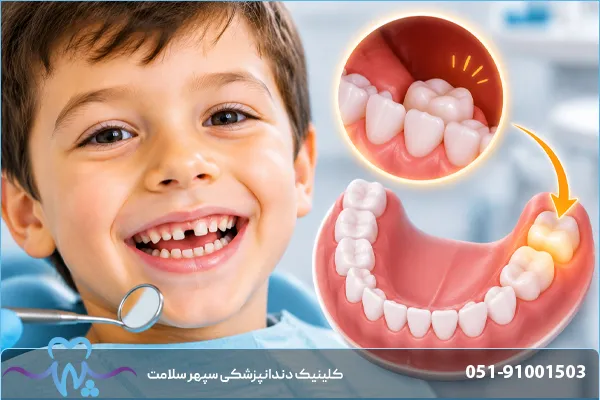 دندان دائمی کودک کدام است؟ معرفی دندان‌هایی که دیگر نمی‌افتند